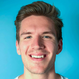 Invisalign Patient – Before Photo
