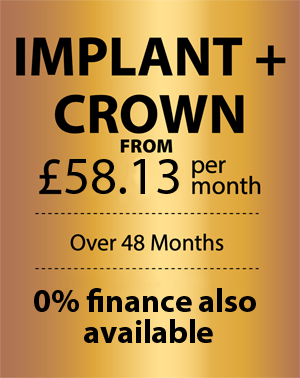 Dental Implants Offers